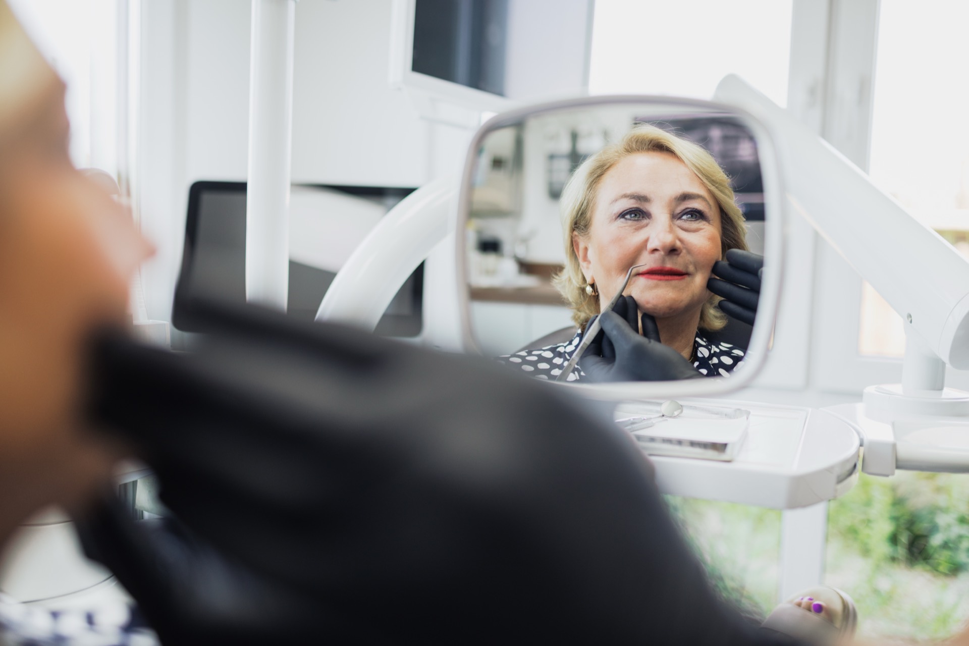 Kontrolle der Lippenkonturen im Spiegel bei der Lip-Flip-Methode in der Stadtwald Klinik