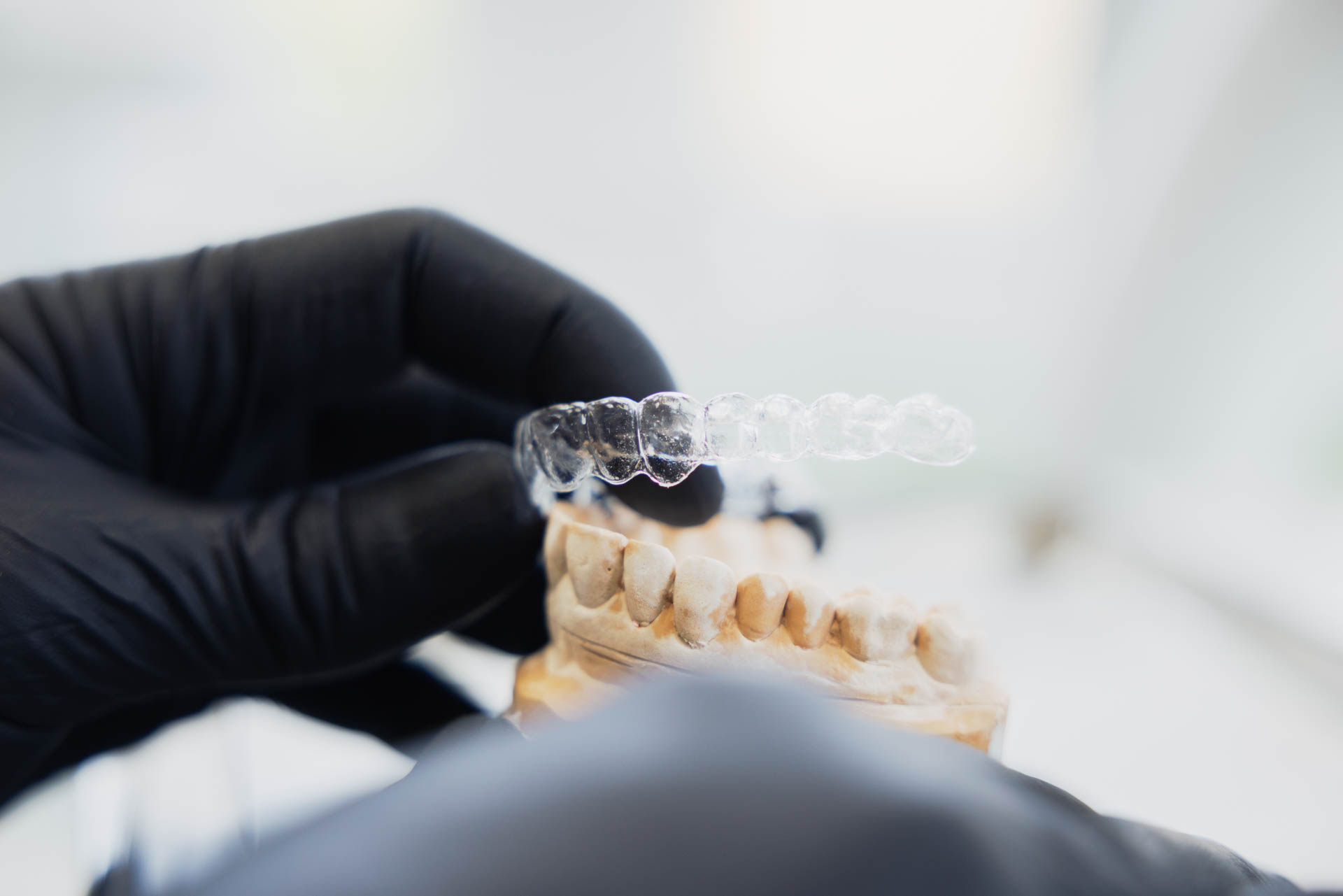 Aligner am Zahnmodell in der Stadtwald Klinik