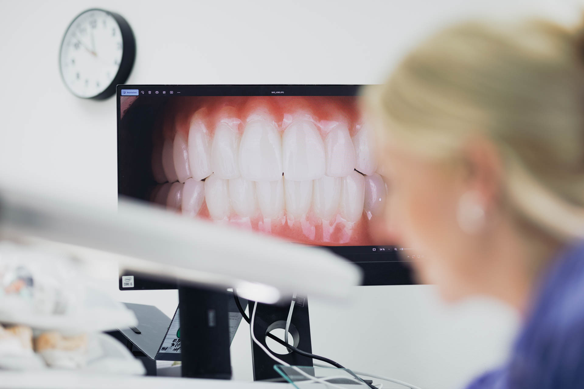 Digitaler 3D-Scan zur OP-Planung in der Stadtwald Klinik