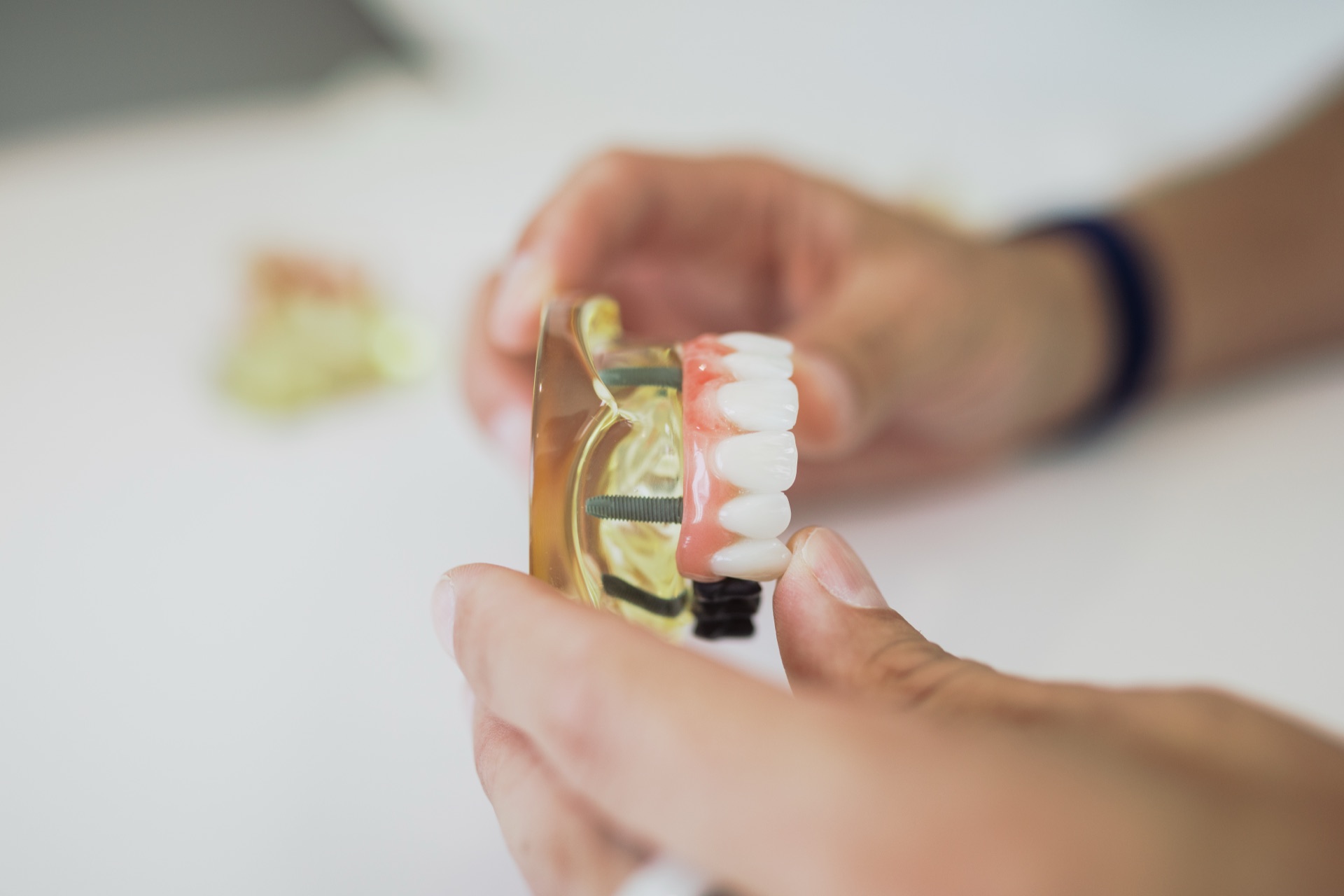 Feininstrument bei der Implantatbehandlung