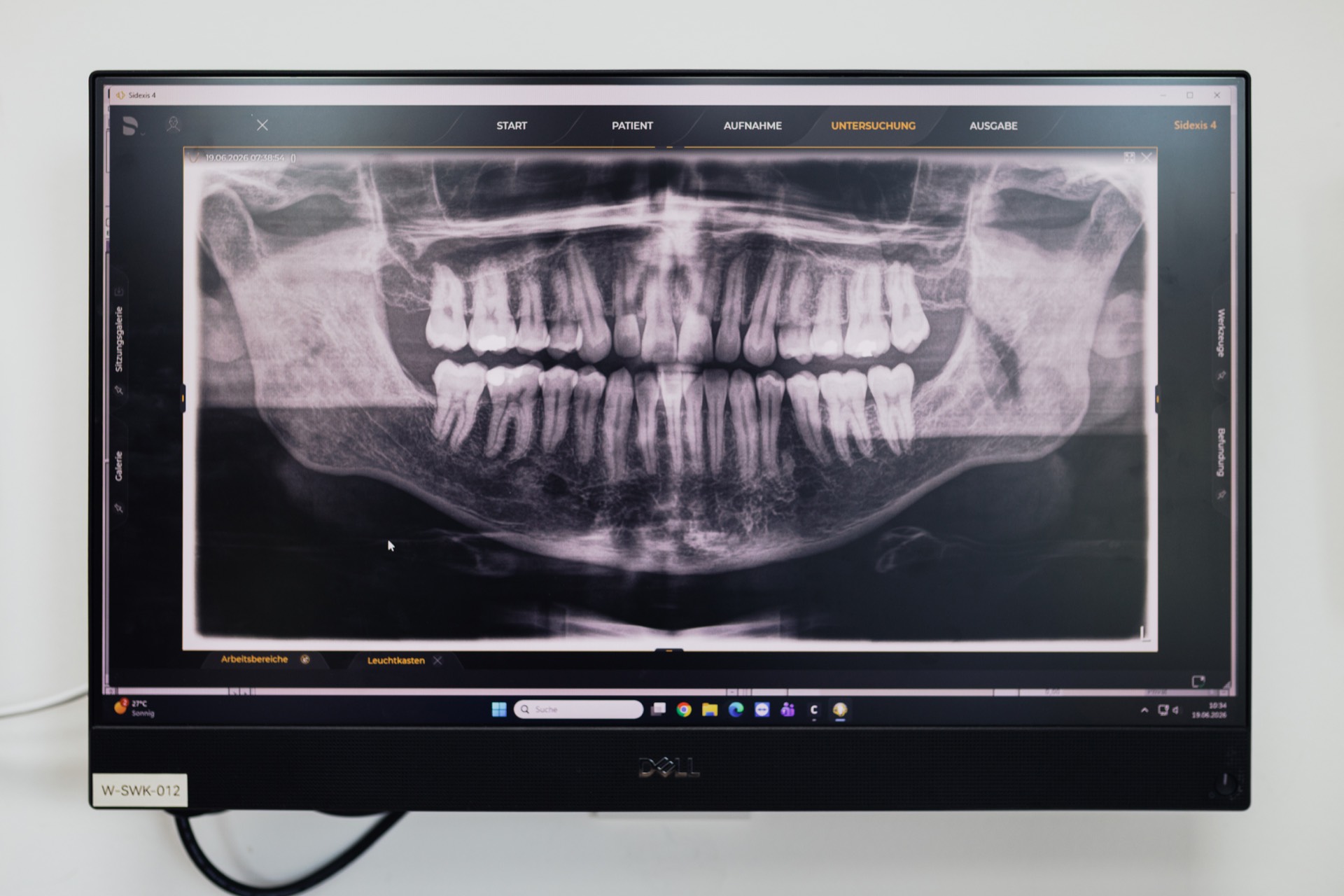 Digitale Röntgenaufnahme des Kiefers in der Stadtwald Klinik