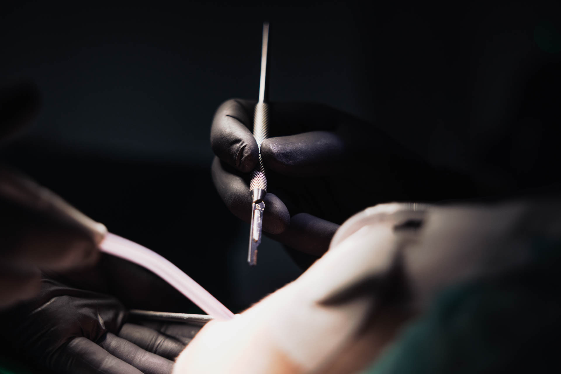 Präzisionsarbeit während des chirurgischen Eingriffs in der Stadtwald Klinik